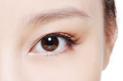 是不是所有人都合适进行开内眼角手术 是不是所有人都合适进行开内眼角手术