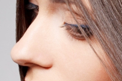 隆鼻手术的恢复期 隆鼻手术的恢复期