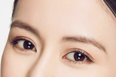 双眼皮切开手术后的注意事项 双眼皮切开手术后的注意事项
