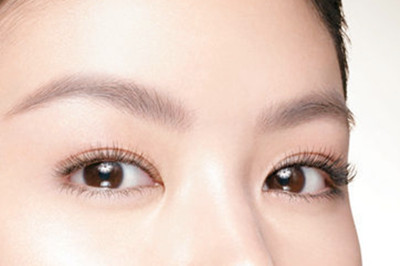 双眼皮切开手术后的注意事项 双眼皮切开手术后的注意事项