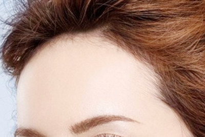 进行完玻尿酸丰额头手术之后几天可以洗脸 进行完玻尿酸丰额头手术之后几天可以洗脸