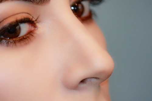 隆鼻手术会不会留疤 隆鼻手术会不会留疤