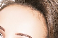 填充丰额头在哪里做好