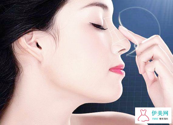 肋软骨隆鼻和异体隆鼻哪个更好 肋软骨隆鼻和异体隆鼻哪个更好