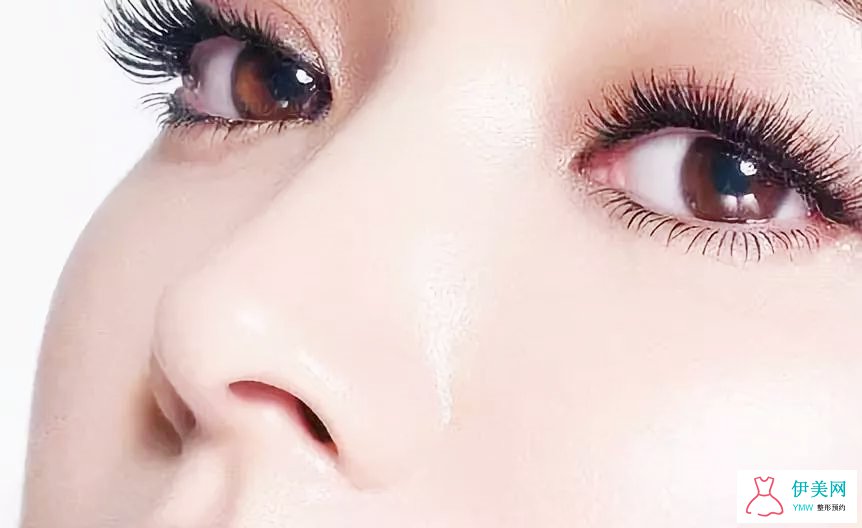 自体隆鼻的注意事项 自体隆鼻的注意事项