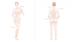 全身吸脂效果如何