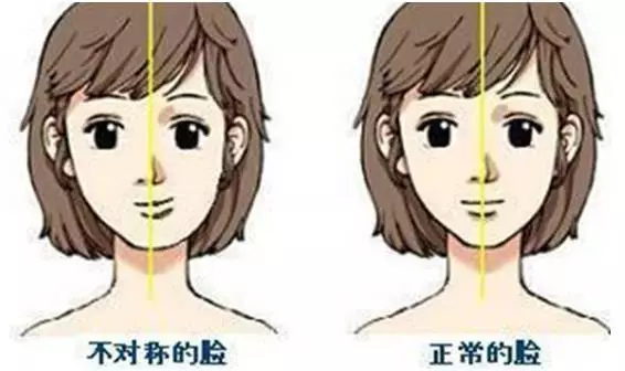 不对称脸型矫正一般多少钱?大小脸怎么矫正? 不对称脸型矫正一般多少钱?大小脸怎么矫正?