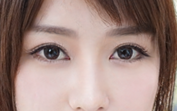 开外眼角手术危险吗?