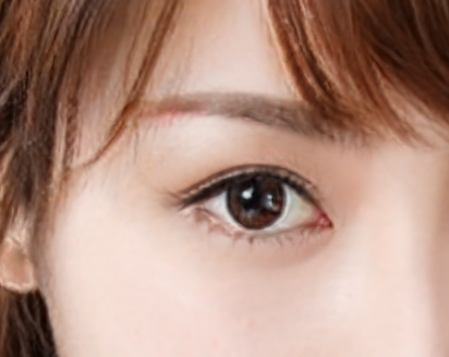 开外眼角会长回去吗?