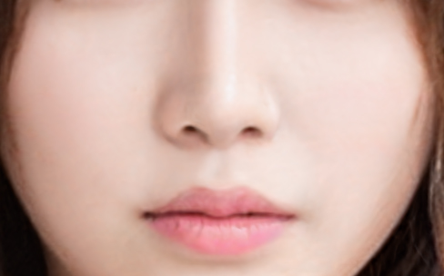 歪鼻矫正手术是怎么做的?