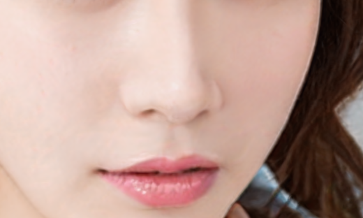 为什么肋软骨隆鼻那么贵?