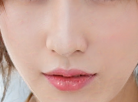 歪鼻矫正手术风险大吗?