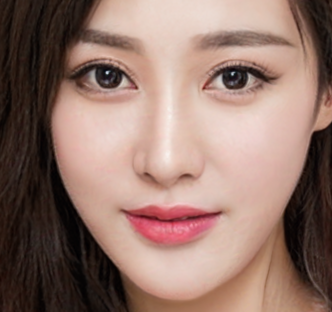 下颌角整形要多少钱?