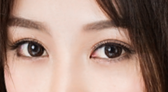 开外眼角手术危险吗?