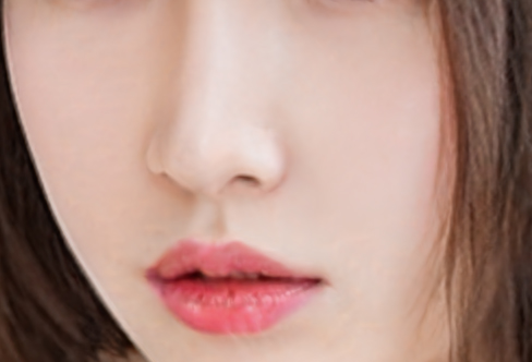 耳软骨隆鼻有什么优势?