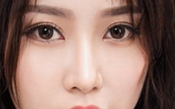 歪鼻矫正手术风险大吗?