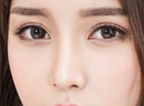 耳软骨隆鼻有什么优势?