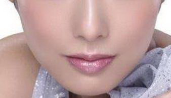 大分子玻尿酸更适合填充苹果肌_脂肪填充苹果肌多少钱